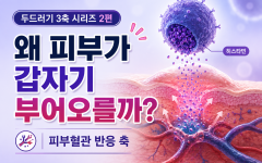 두드러기 반복 원인 2편 | 왜 피부가 갑자기 부어오를까?