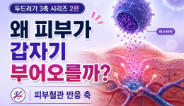 두드러기 반복 원인 2편 | 왜 피부가 갑자기 부어오를까?